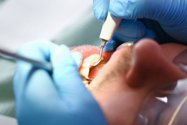Best Emergency Denture Repair in St Georges, DE