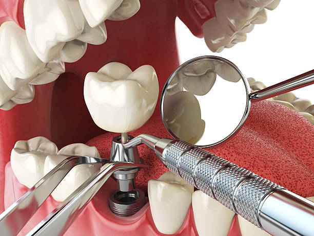 Best Emergency Root Canal Therapy in St Georges, DE